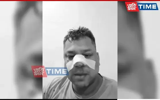 Assam: Nagaon AAP Leader Alleges Assault By BJP Workers