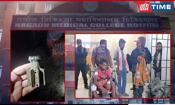 BREAKING: 4 Minors Injured in Abandoned Grenade Explosion in Nagaon