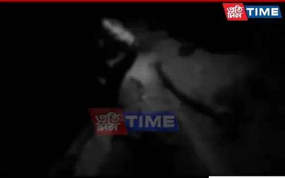 Guwahati: Younger Brother Hacked By Elder Sibling Fights For Life