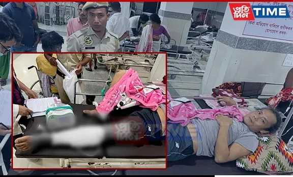 Guwahati: Man Apprehended With Gunshot Wound; Extremist Group Links Probed