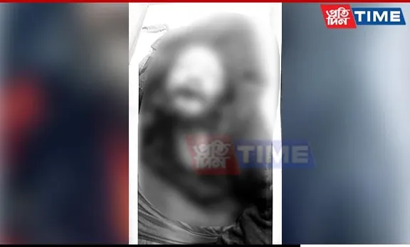 Unidentified Man Found Dead at Nilachal Hills in Guwahati; Police Suspect Road Accident