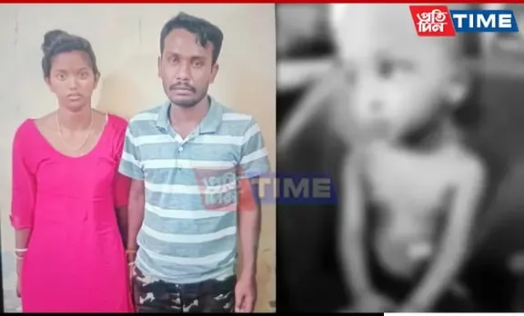 Assam: Silchar Parents Pour Hot Oil On 3-Year-Old For "Crying Too Much"