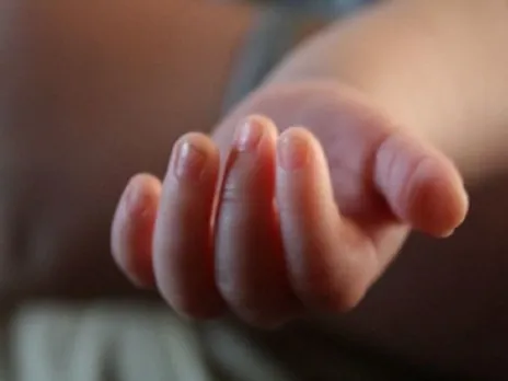 Measles claims lives of 7 children in Pakistan