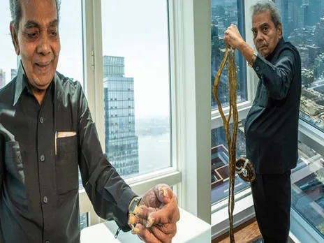 Guinness World Record holder Shridhar Chillal clips nails after 66 years
