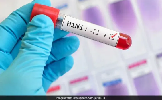 Swine flu cases on rise in Assam