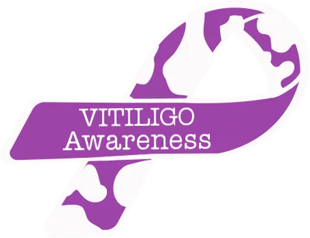 Vitiligo-Walk in City