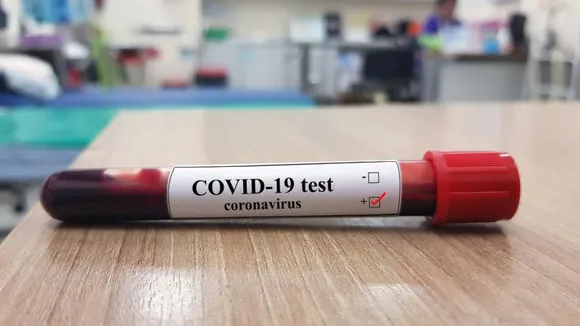 Delhi: No of COVID-19 Patient from Assam Rise to 11