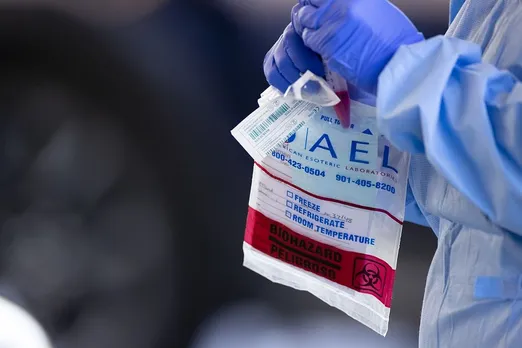 7,800 Rapid Test Kits Available at Mizoram