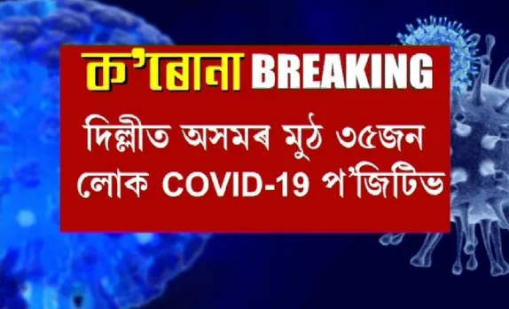 Delhi: No of COVID cases from Assam Rise to 35