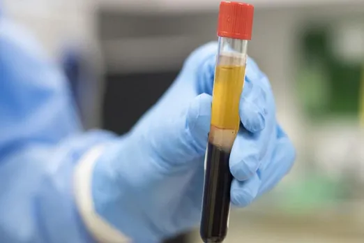 ICMR Study ‘Questions’ Plasma Therapy