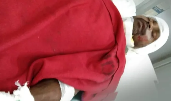 Tea Worker Injured After Accident With HBS Convoy