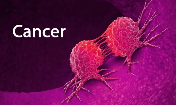 India has Highest Burden of Cervical Cancer: Report