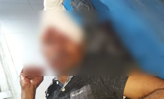 Guwahati: Leopard Attacks Man In Maligaon