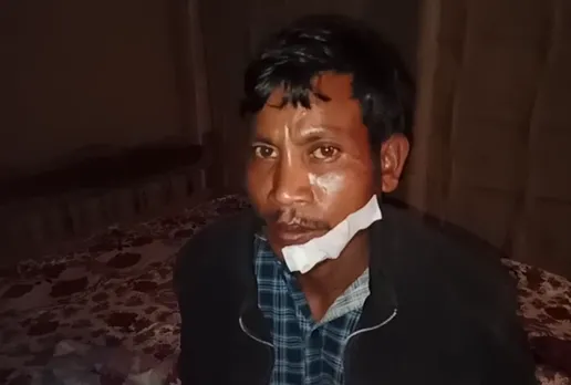Leopard Attack In Bokakhat: One Injured