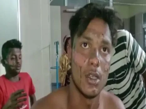 Bengal: 6 BJP Workers Injured In Bomb Attack