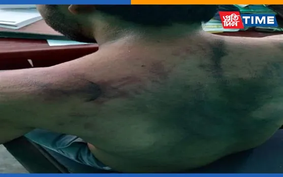 Assam: 24 Persons Arrested In Doctor Assault Case