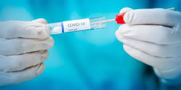 After Covishelf, Abbott Launches Covid-19 Home Test Kits In India