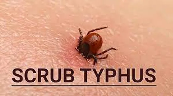 Guwahati: 7 Including Doctors Infected with ‘Scrub Typhus’