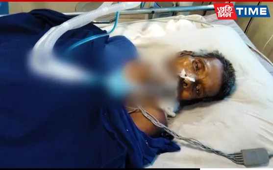 Guwahati: Victim of Drunk And Hit Case Dies At GMCH