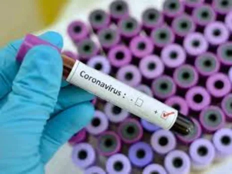 COVID-19: Assam Logs 8,339 New Cases, 15 Deaths