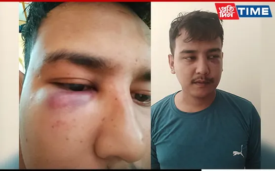 Gang Of 6 Youths Thrash 2 Traffic Police In Panbazar