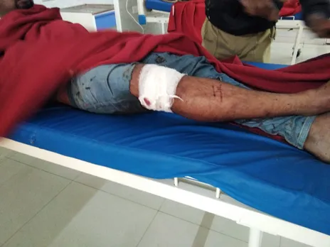 Assam: 3 Drug Peddlers Injured in Police Firing