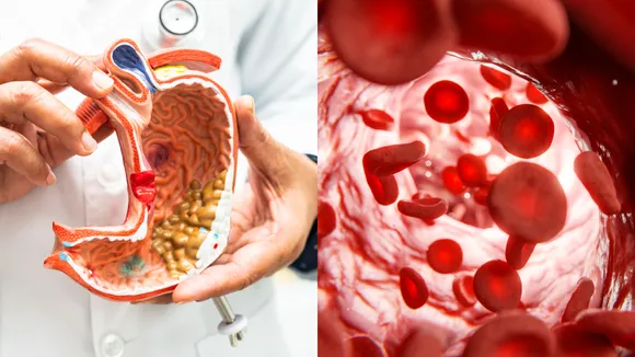 Cholesterol
