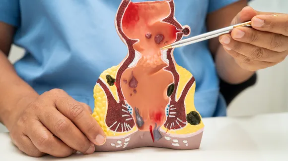 Bad Cholesterol