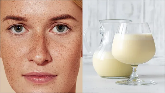 Raw Milk Dark Spots