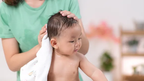 children baldness