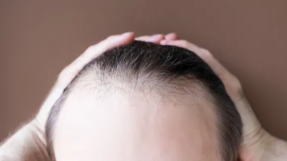 Bald Hair