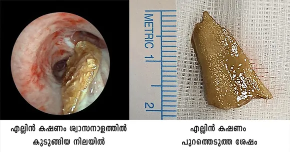 swasakosham12