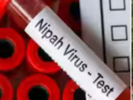 nipah negative virus