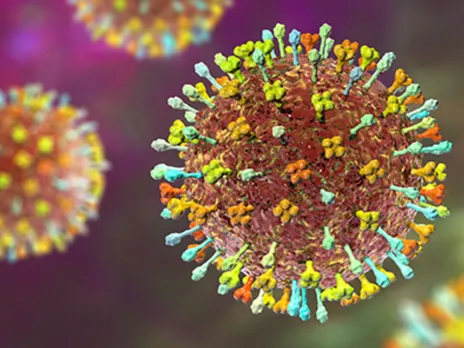 nipah virus