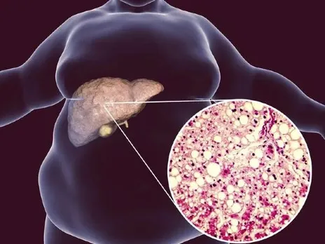 71ae6afc-b247-40b3-9f04-8abae3f25fec (1)