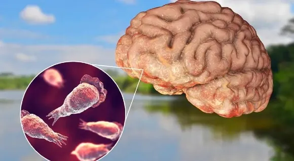 627852ca-80a4-4092-9f02-19d9fd4656f2