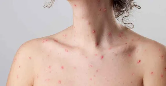 96228da4-9c8b-4735-9769-2a1f1a3955e1