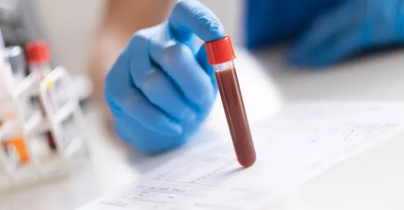 cfea5cf4-d06e-44a6-96f3-a38e35cd8d1e