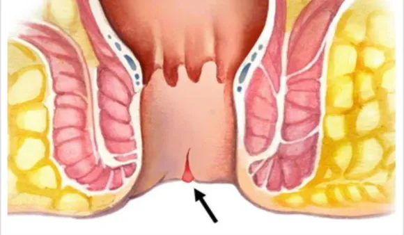 73f7c355-f851-41f0-ad75-4073fd2c6bc9