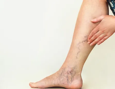 bed73b5d-05b3-4d01-87d0-771c7a03e3f1