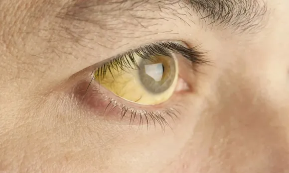yellow fever Untitled.98.jpg