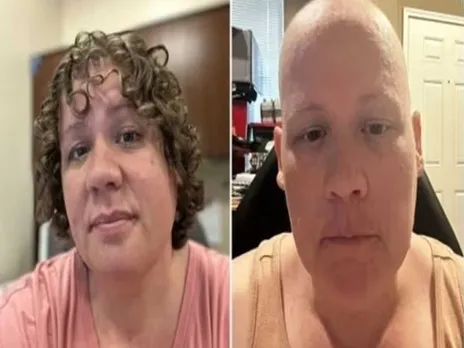 liza cancer1.jpg