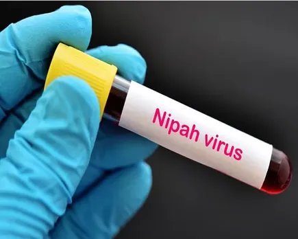 nipah negative