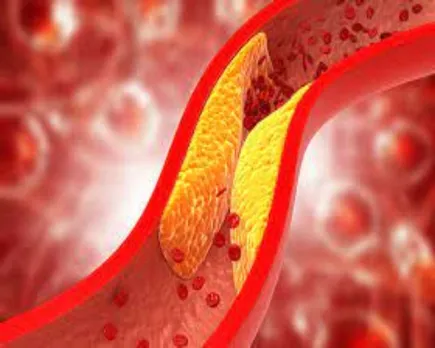 high-cholesterol-foods-to-avoid