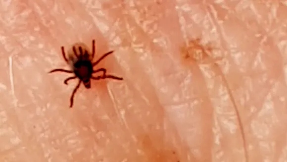 lyme (1).jpg