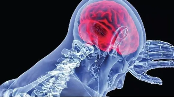 amoebic encephalitis