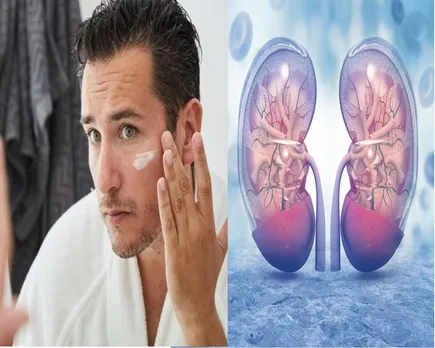 fairness cream malappuram