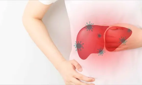 hepatitis