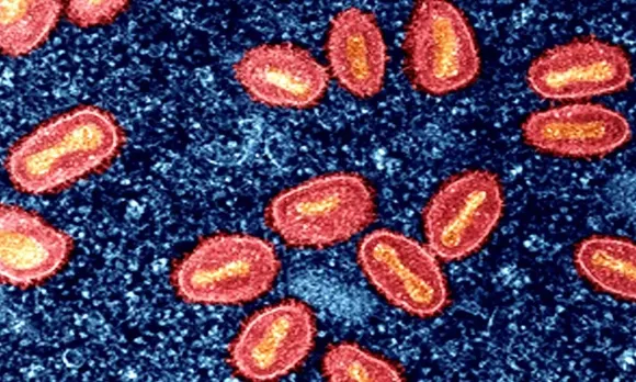 Mpox 