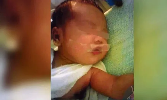 നവജാത ശിശു കരയാതിരിക്കാൻ നഴ്സ് കുഞ്ഞിന്റെ ചുണ്ടിൽ പ്ലാസ്റ്റർ ഒട്ടിച്ചു, സംഭവം മുംബൈയിൽ